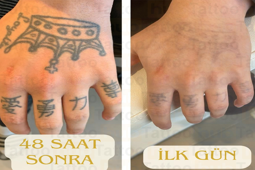upload/Before & After